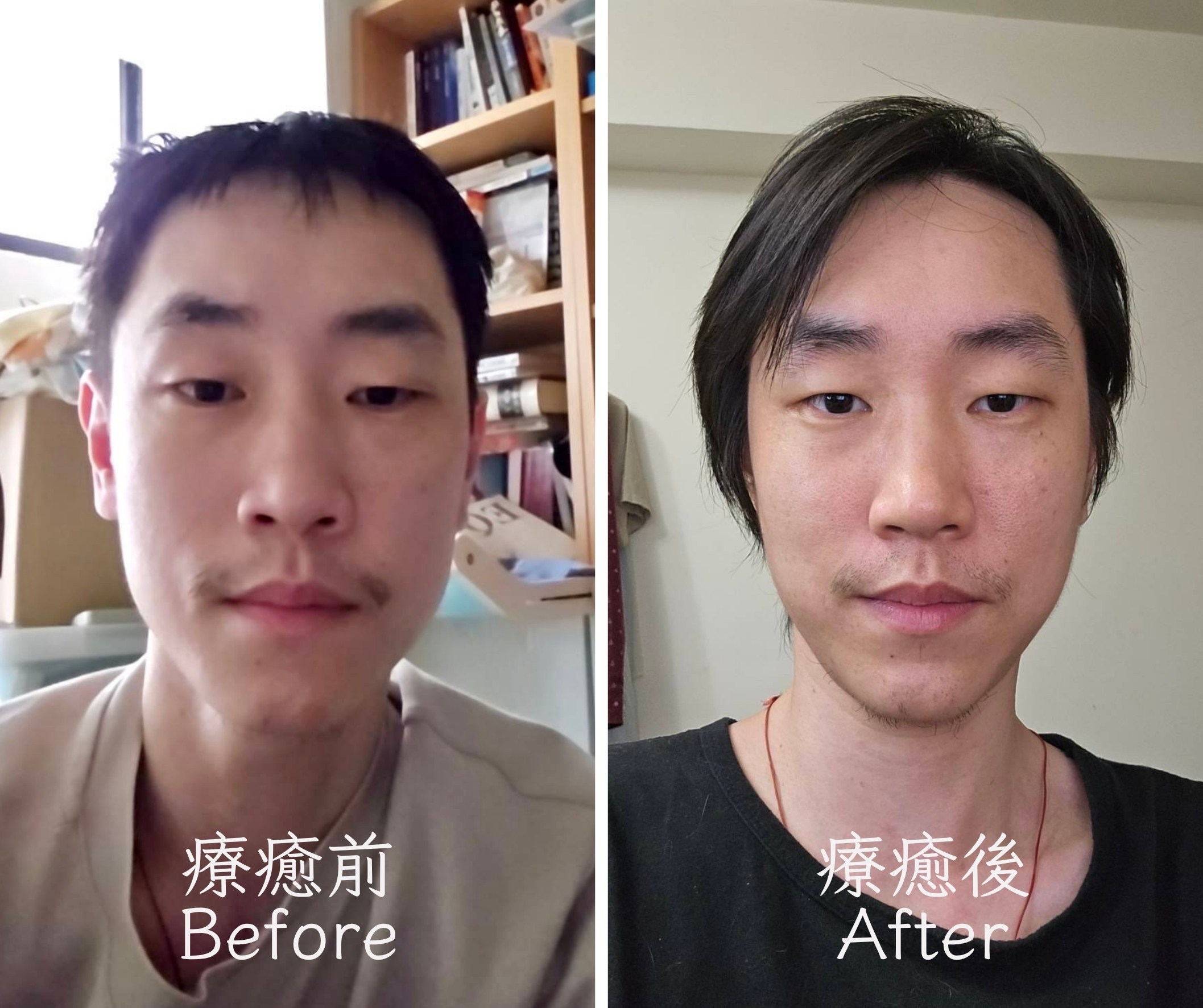 解業療癒前後對比圖